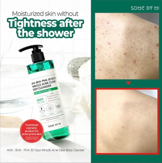 غسول الجسم المعجزة لتطهير حب الشباب 30 يوم من سوم باي مي (Some By Mi AHA.BHA.PHA 30 Days Miracle Acne Clear Body Cleanser)