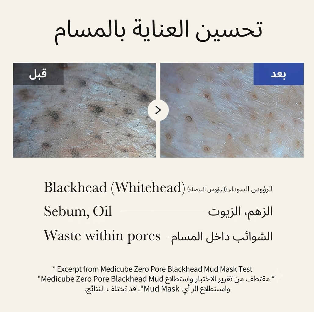 قناع الطين لإزالة الرؤوس السوداء زيرو بور ميديكوب (Medicube Zero Pore Blackhead Mud Mask)